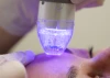 Vivace behandeling