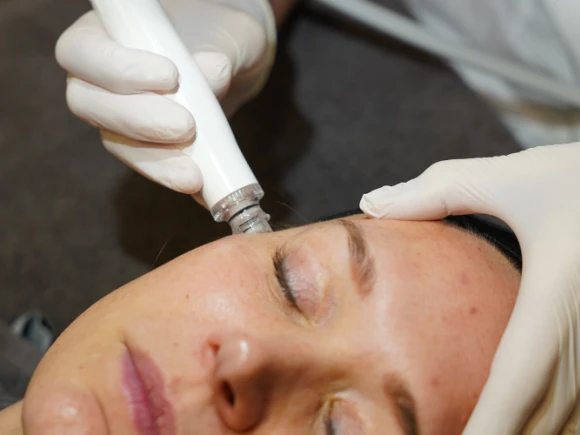Hydrafacial-5