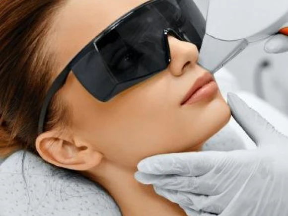 laserontharing-6