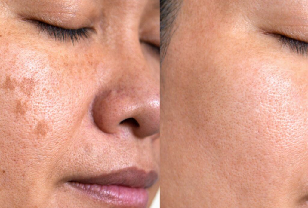 From pigmentation spots to flawless skin: how we help you cover