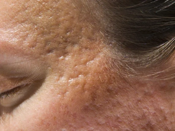 Untitled-design-18 (1)