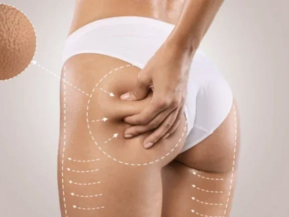 Connective-Tissue-Massage-With-Icoone-3 (1)