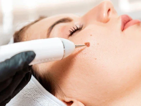 Coagulation-Treatment-3