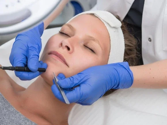 Elektrische-Epilatie-2